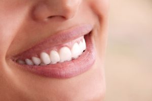 a woman’s new white and beautiful smile with veneers
